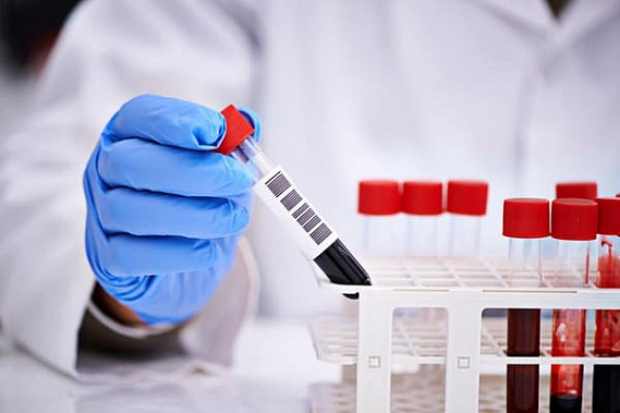 Сдайте анализы перед тренировкой