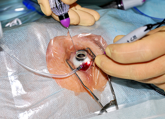 Офтальмологов приглашают в Ростов-на-Дону на межрегиональную конференцию