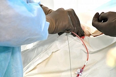 18 10 2025 Новые высокотехнологичные операции проводятся в Ростове