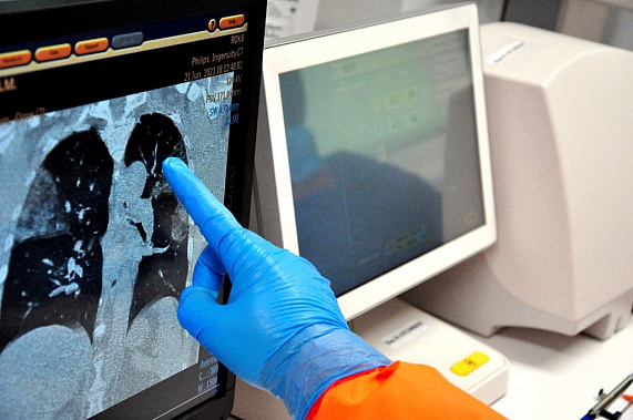 Кобзев: В Ростовской области единицы попадают в стационары после вакцинации от ковида