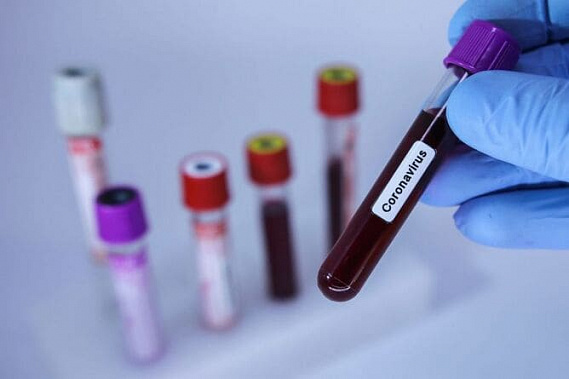 На Дону за сутки выявили еще 239 заболевших коронавирусной инфекцией