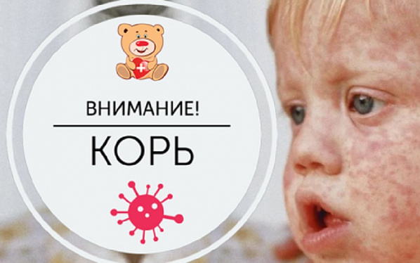 В Ростове и на Дону продолжает расти заболеваемость корью