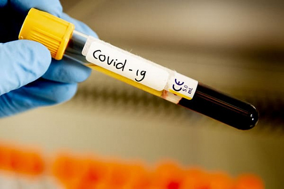 В Ростовской области за сутки зарегистрировано 128 случаев коронавирусной инфекции