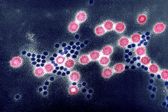 Так выглядит ротавирус под электронным микроскопом. Источник фото: BSIP/UIG Via Getty. Images.